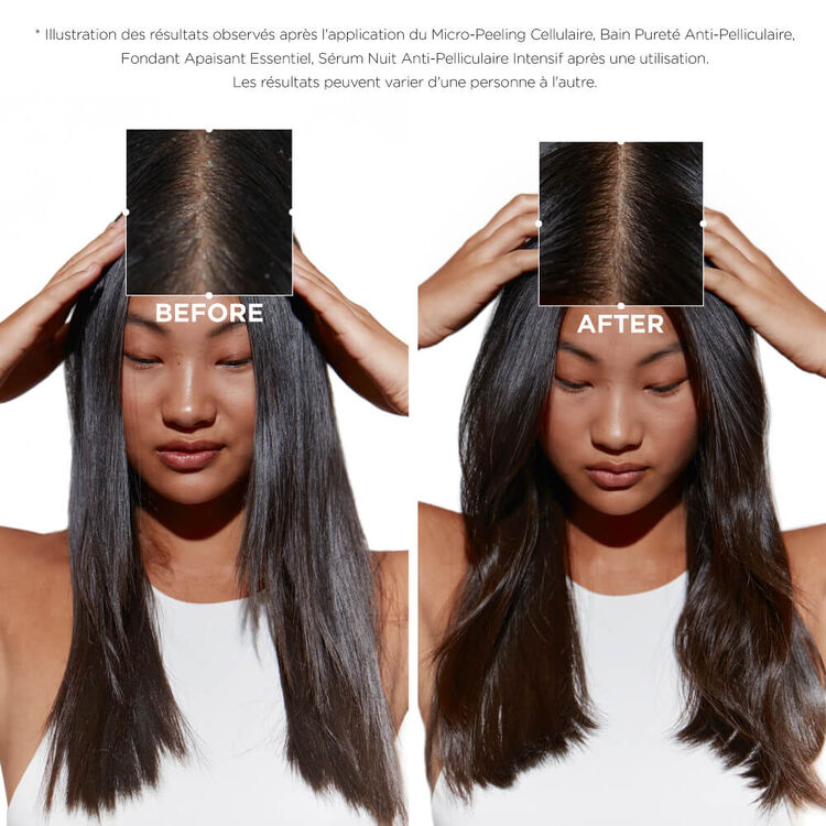 Trio Symbiose anti-pelliculaire cuir chevelu gras